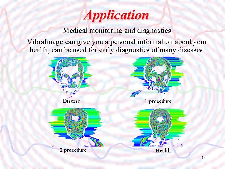 Application Medical monitoring and diagnostics Vibra. Image can give you a personal information about