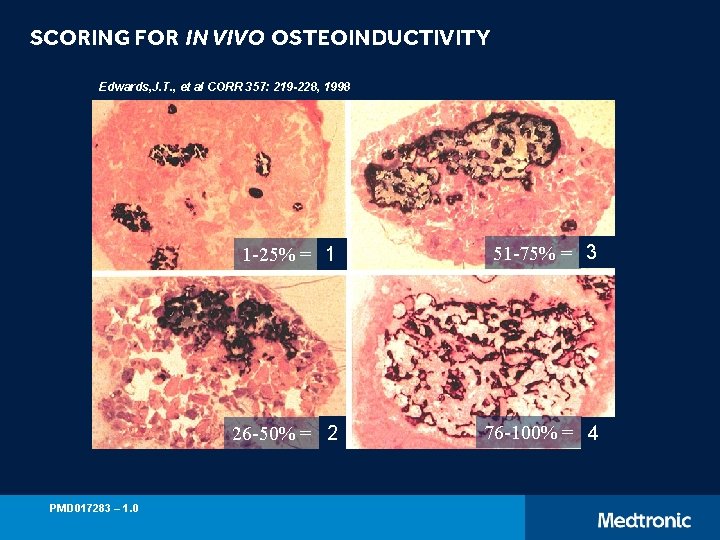 SCORING FOR IN VIVO OSTEOINDUCTIVITY Edwards, J. T. , et al CORR 357: 219