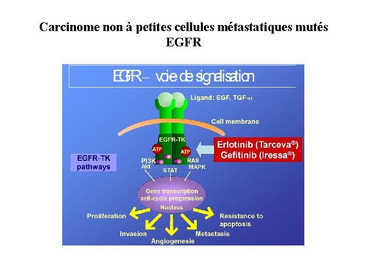 Carcinome non à petites cellules métastatiques mutés EGFR 