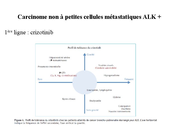 Carcinome non à petites cellules métastatiques ALK + 1ère ligne : crizotinib 