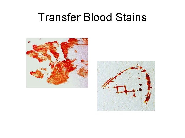Transfer Blood Stains 