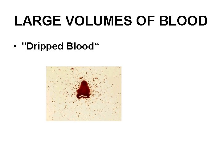 LARGE VOLUMES OF BLOOD • "Dripped Blood“ 