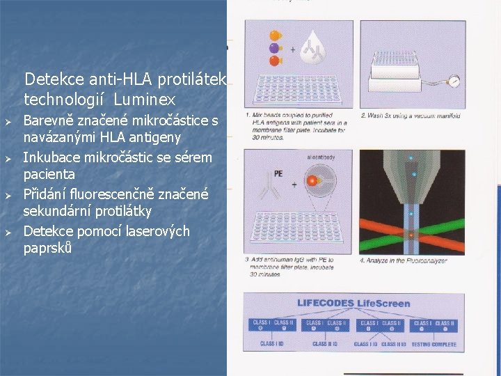  Detekce anti-HLA protilátek technologií Luminex Ø Ø Barevně značené mikročástice s navázanými HLA