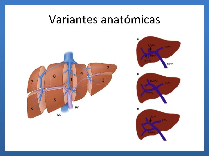 Variantes anatómicas 