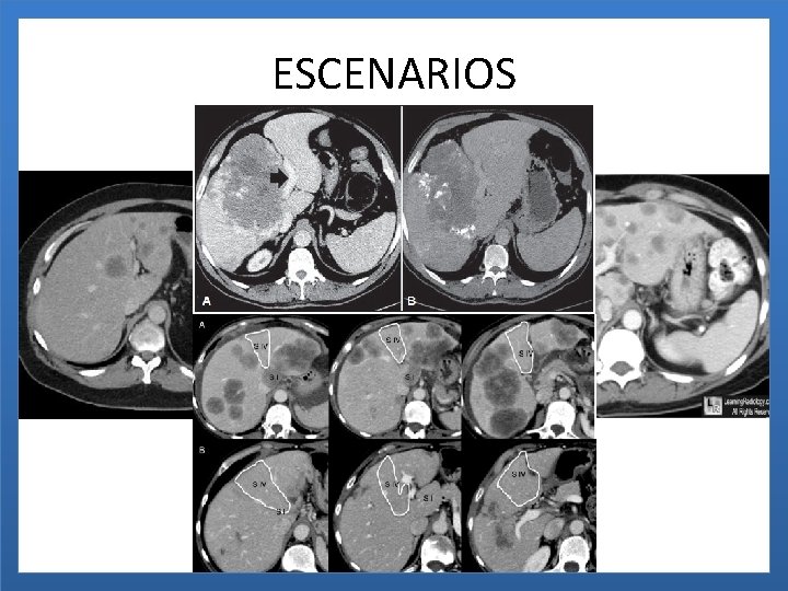 ESCENARIOS 