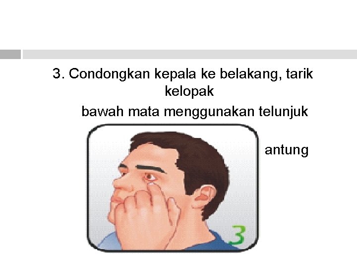 3. Condongkan kepala ke belakang, tarik kelopak bawah mata menggunakan telunjuk sehingga kelopak mata