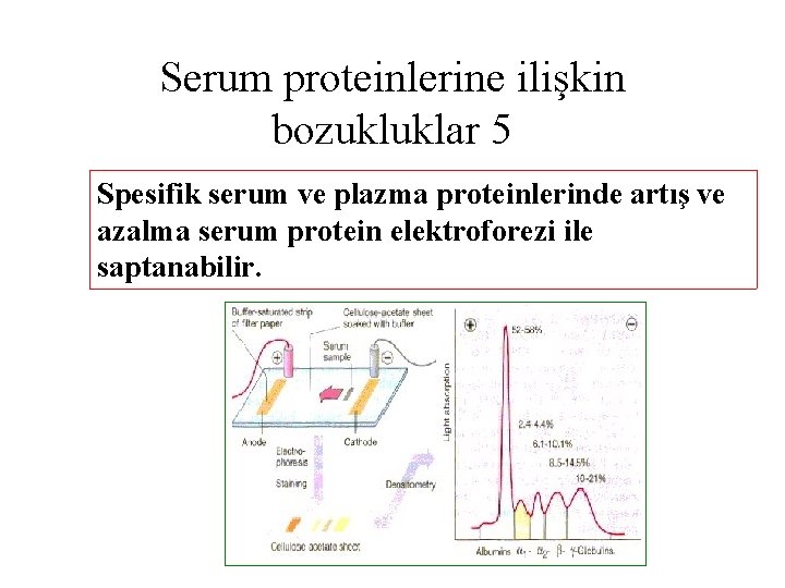 Serum proteinlerine ilişkin bozukluklar 5 Spesifik serum ve plazma proteinlerinde artış ve azalma serum