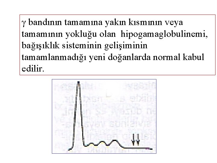 γ bandının tamamına yakın kısmının veya tamamının yokluğu olan hipogamaglobulinemi, bağışıklık sisteminin gelişiminin tamamlanmadığı