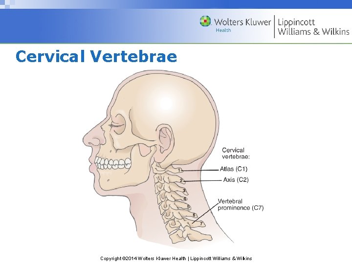 Cervical Vertebrae Copyright © 2014 Wolters Kluwer Health | Lippincott Williams & Wilkins Cervical Vertebrae Copyright © 2014 Wolters Kluwer Health | Lippincott Williams & Wilkins