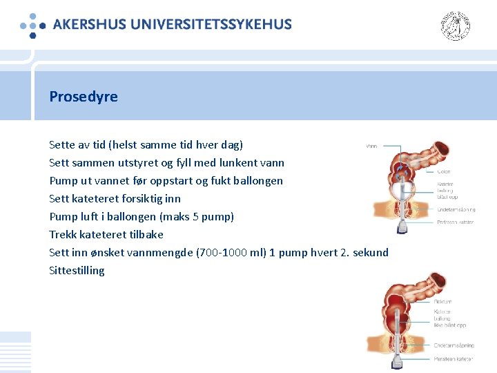 Prosedyre Sette av tid (helst samme tid hver dag) Sett sammen utstyret og fyll