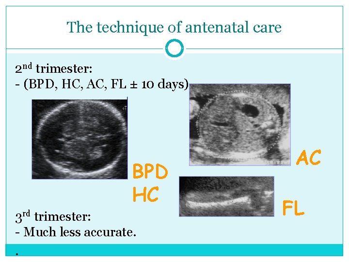 The technique of antenatal care 2 nd trimester: - (BPD, HC, AC, FL ±