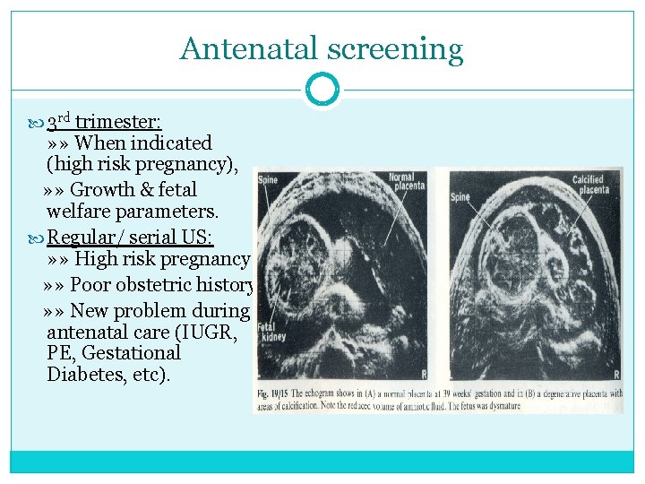 Antenatal screening 3 rd trimester: » » When indicated (high risk pregnancy), » »