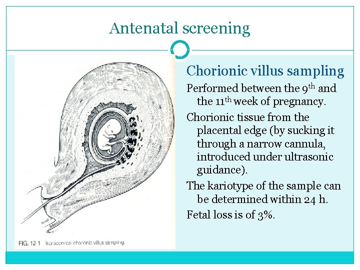 Antenatal screening Chorionic villus sampling Performed between the 9 th and the 11 th