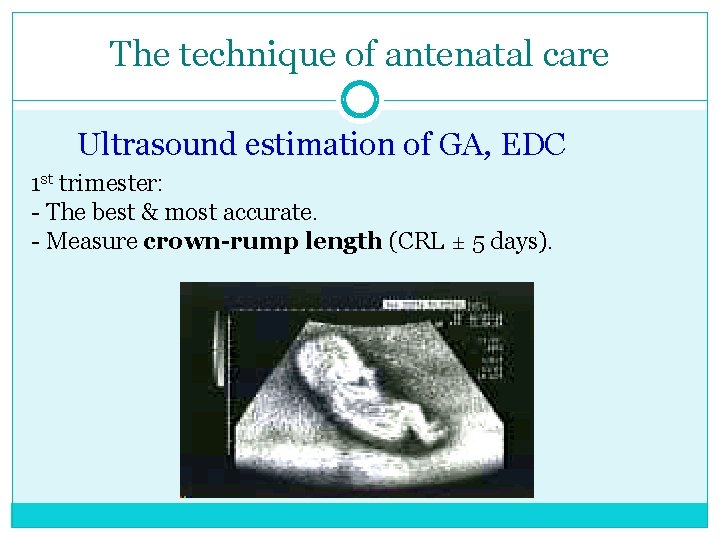 The technique of antenatal care Ultrasound estimation of GA, EDC 1 st trimester: -