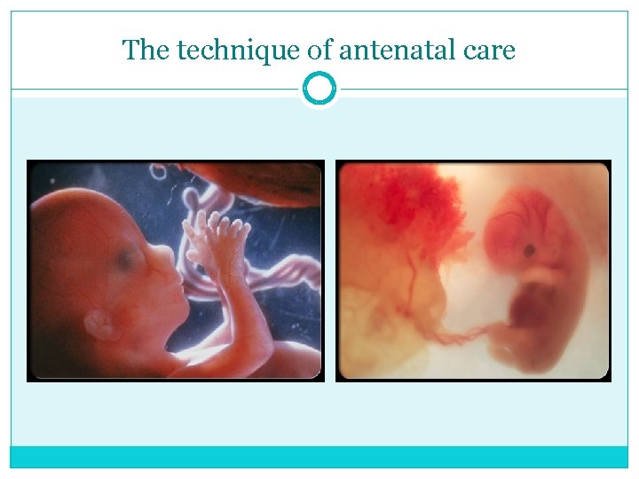 The technique of antenatal care 