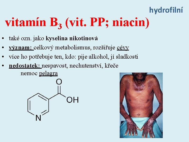 hydrofilní vitamín B 3 (vit. PP; niacin) • • také ozn. jako kyselina nikotinová