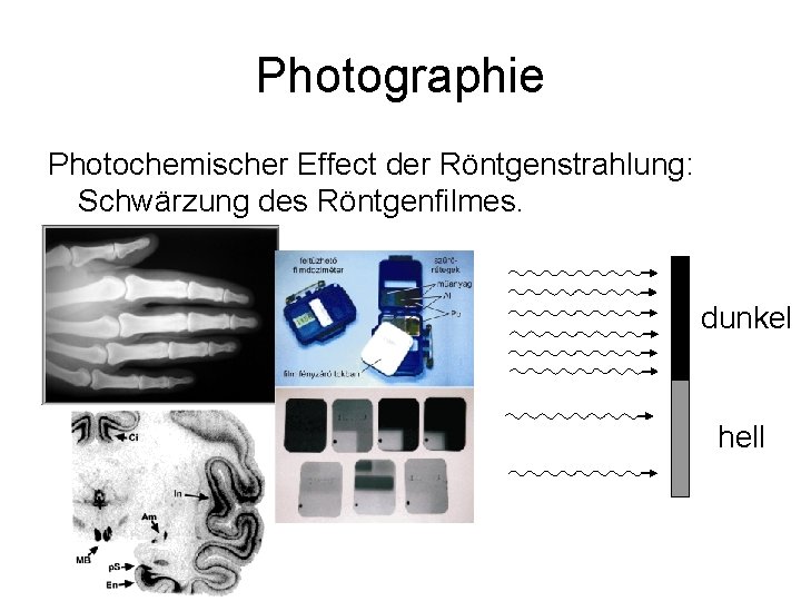 Photographie Photochemischer Effect der Röntgenstrahlung: Schwärzung des Röntgenfilmes. dunkel hell 