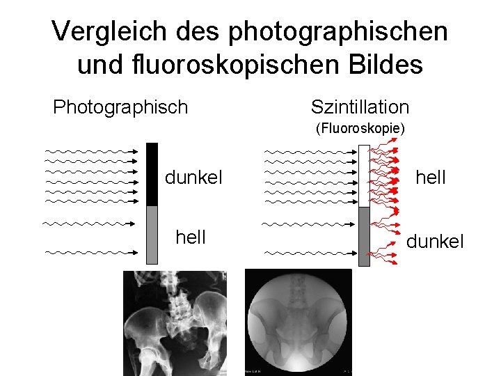 Vergleich des photographischen und fluoroskopischen Bildes Photographisch Szintillation (Fluoroskopie) dunkel hell dunkel 