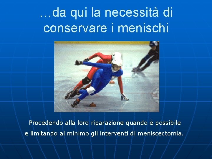 …da qui la necessità di conservare i menischi Procedendo alla loro riparazione quando è