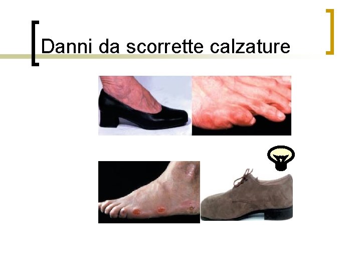 Danni da scorrette calzature 