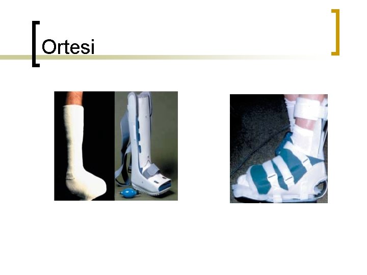 Ortesi 
