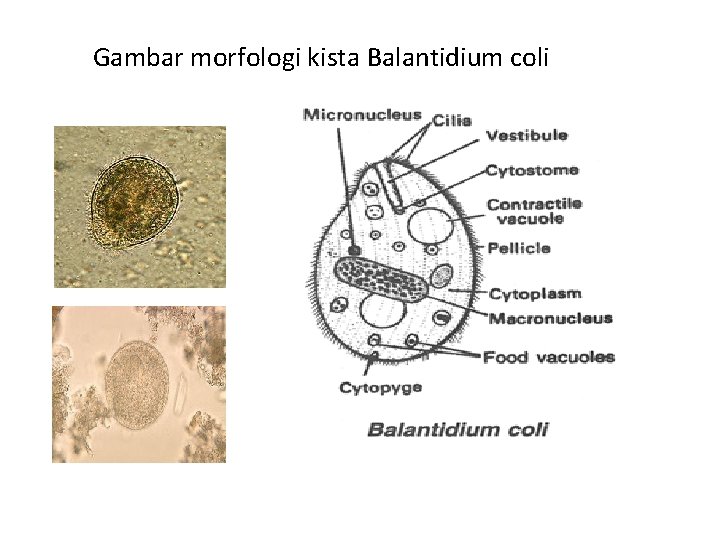 Gambar morfologi kista Balantidium coli 