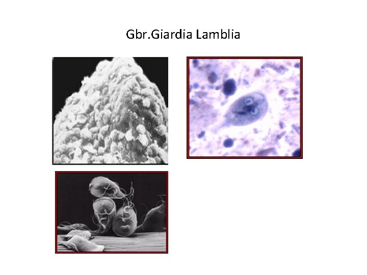 Gbr. Giardia Lamblia 