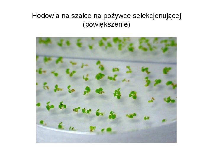 Hodowla na szalce na pożywce selekcjonującej (powiększenie) 