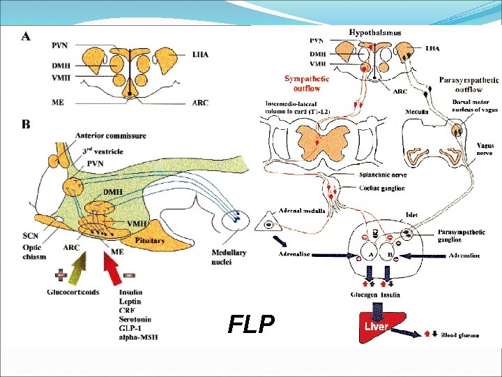 FLP 