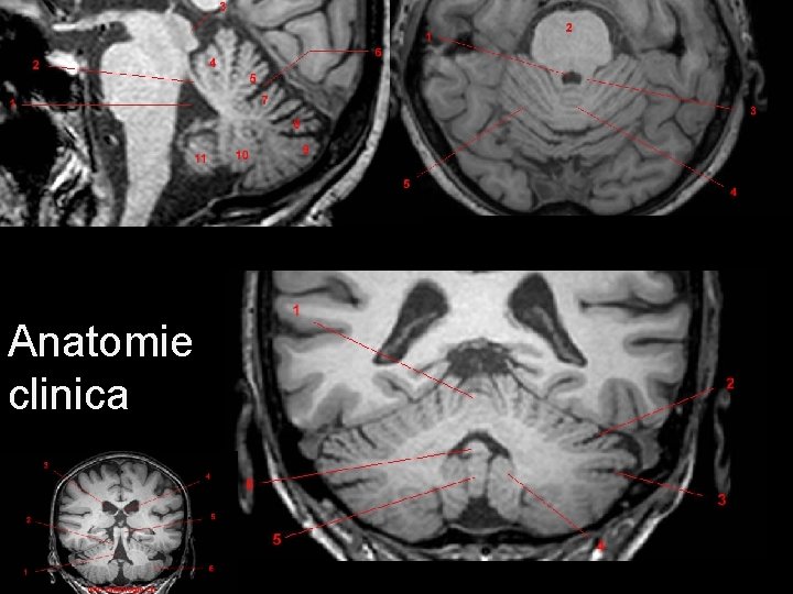 Anatomie clinica 