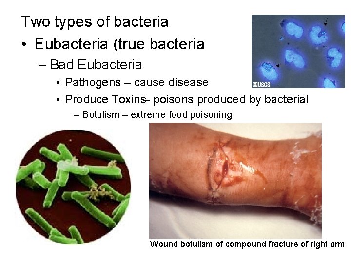 Two types of bacteria • Eubacteria (true bacteria – Bad Eubacteria • Pathogens –