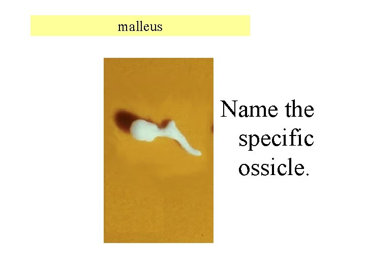 malleus Name the specific ossicle. 