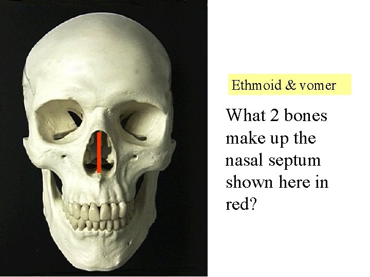 Ethmoid & vomer What 2 bones make up the nasal septum shown here in