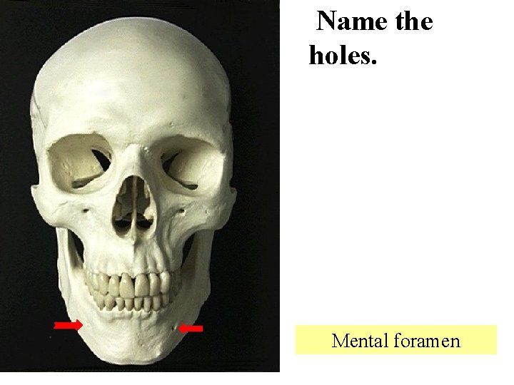  Name the holes. Mental foramen 
