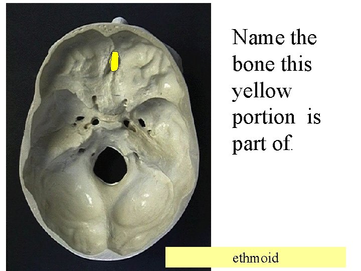 Name the bone this yellow portion is part of. ethmoid 