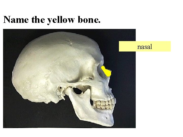 Name the yellow bone. nasal 