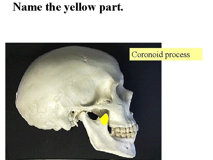 Name the yellow part. Coronoid process 