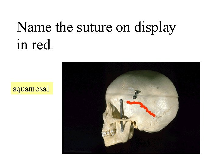 Name the suture on display in red. squamosal 