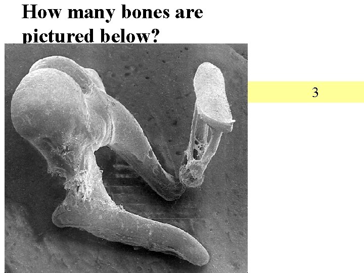 How many bones are pictured below? 3 