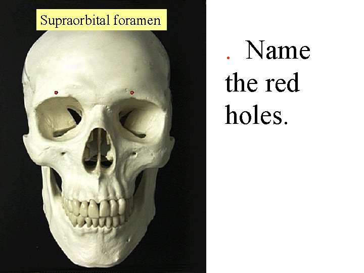 Supraorbital foramen . Name the red holes. 