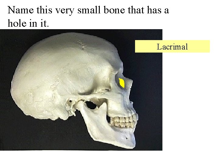 Name this very small bone that has a hole in it. Lacrimal 