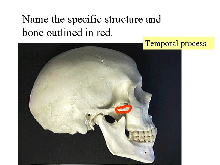 Name the specific structure and bone outlined in red. Temporal process 