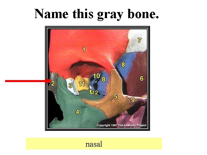Name this gray bone. nasal 