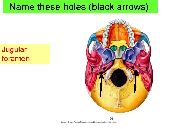 Name these holes (black arrows). Jugular foramen 