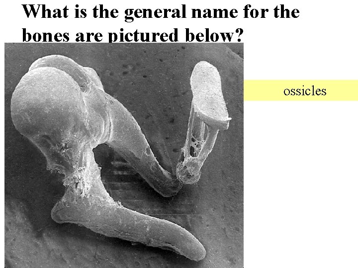 What is the general name for the bones are pictured below? ossicles 