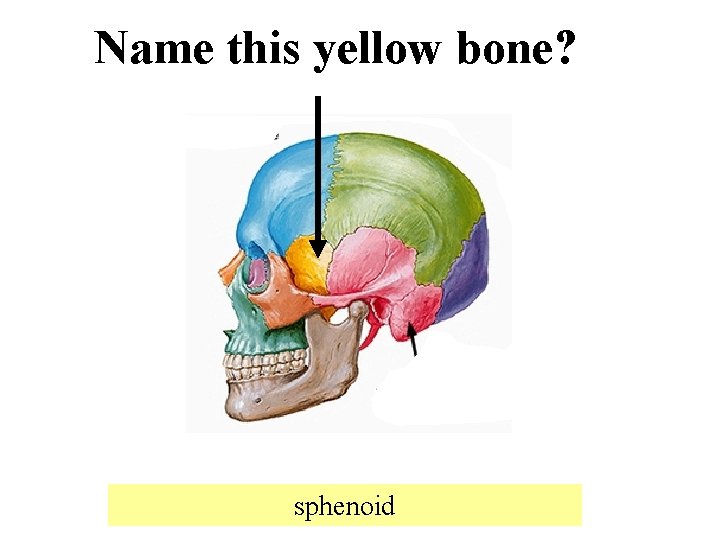 Name this yellow bone? sphenoid 