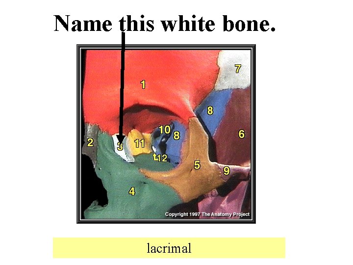 Name this white bone. lacrimal 