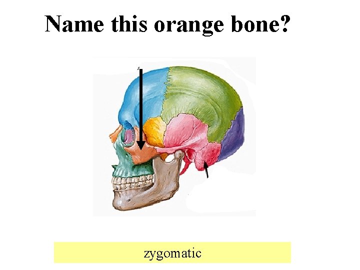 Name this orange bone? zygomatic 