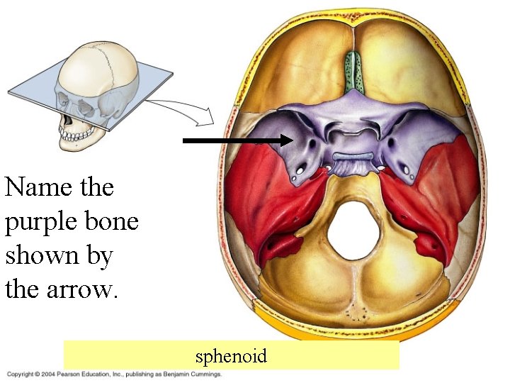 Name the purple bone shown by the arrow. sphenoid 