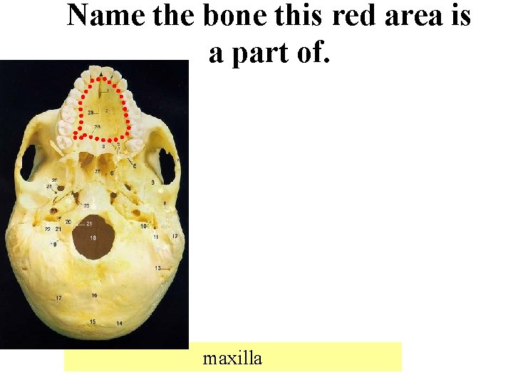 Name the bone this red area is a part of. maxilla 